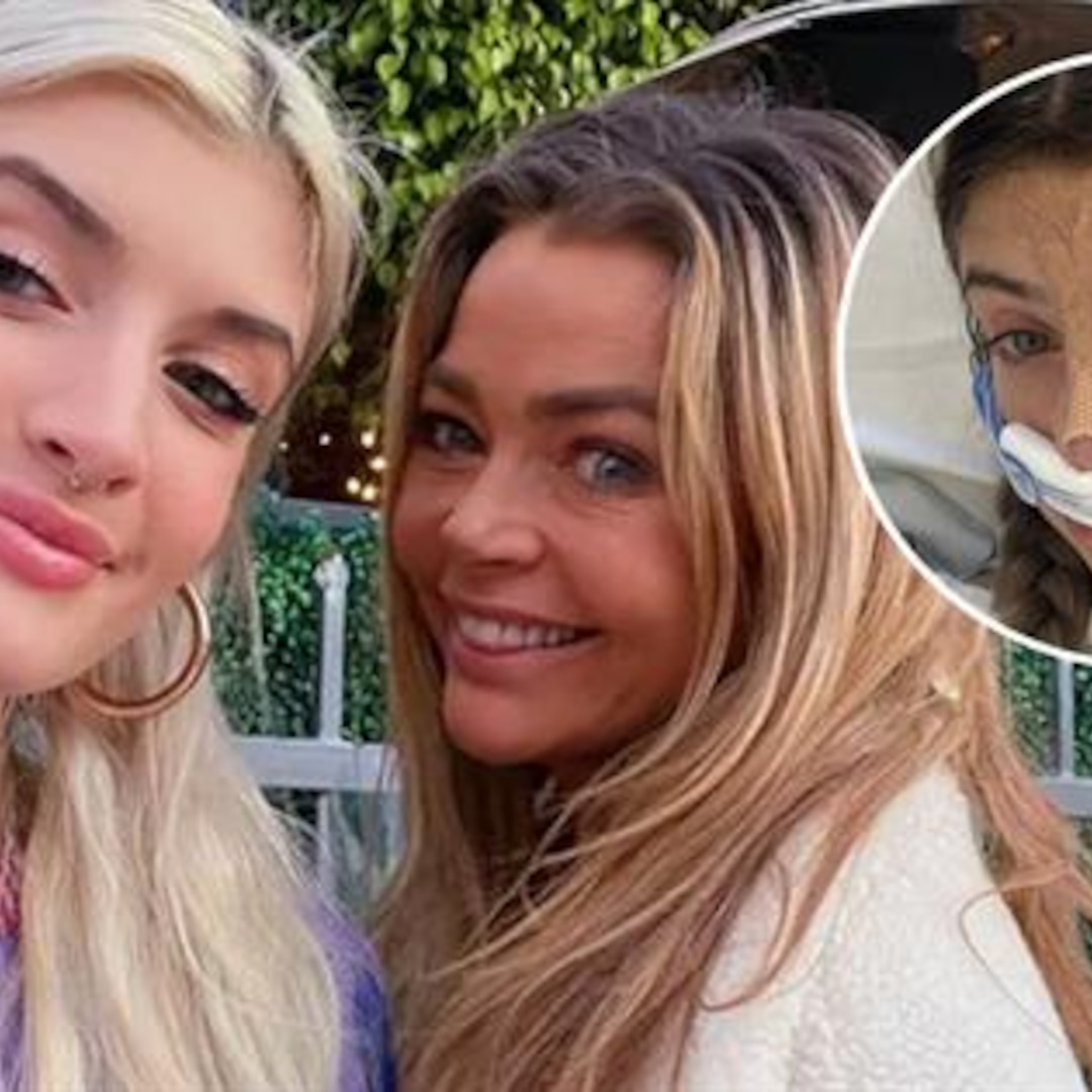 Charlie Sheen’s Daughter Sami Shares New Plastic Surgery Procedure Results Charlie Sheen’s Daughter Sami Shares New Plastic Surgery Procedure Results